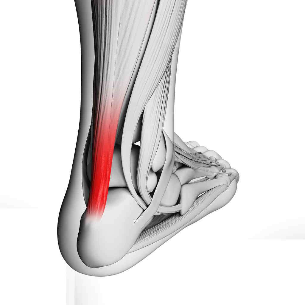 Anatomical diagram of the Achilles tendon