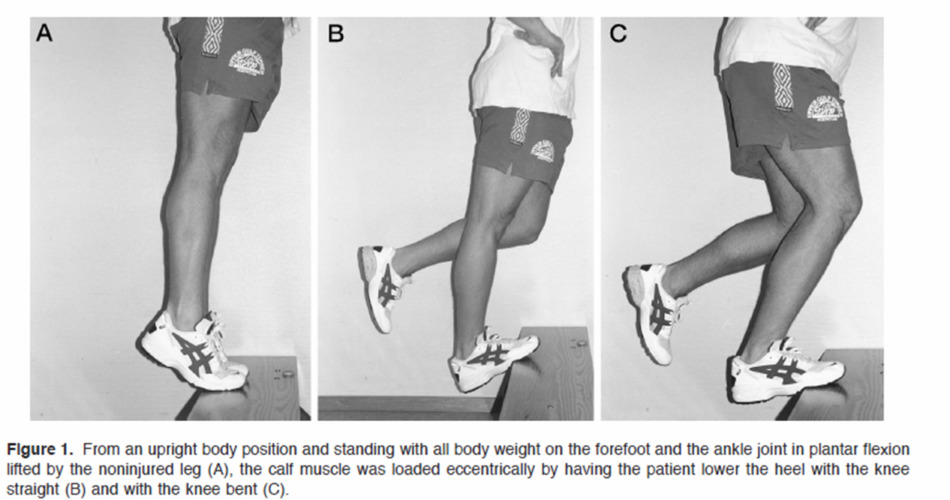 Progressive loading exercises for Achilles tendinopathy rehabilitation